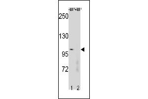 Western blot analysis of CTNNB1 Antibody (N-term) Pab (ABIN1881235 and ABIN2843231) pre-incubated without(lane 1) and with(lane 2) blocking peptide in human placenta tissue lysate. (CTNNB1 Antikörper  (N-Term))