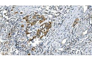 IHC analysis of DRP1/DNM1L using anti-DRP1/DNM1L antibody (ABIN7602180). (Dynamin 1-Like Antikörper  (AA 618-736))