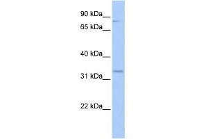 WB Suggested Anti-RFPL4B Antibody Titration:  0. (RFPL4B Antikörper  (Middle Region))