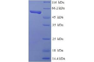 SDS-PAGE (SDS) image for TEA Domain Family Member 4 (TEAD4) (AA 74-434), (partial) protein (His-SUMO Tag) (ABIN5711273)