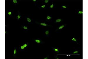 Immunofluorescence of monoclonal antibody to CBX1 on HeLa cell. (CBX1 Antikörper  (AA 2-99))