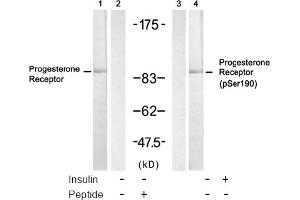 Image no. 2 for anti-Progesterone Receptor (PGR) (Ser190) antibody (ABIN319298) (Progesterone Receptor Antikörper  (Ser190))