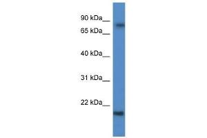Western Blot showing KRTAP1-5 antibody used at a concentration of 1 ug/ml against Fetal Brain Lysate