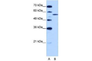 ZRSR2 antibody used at 2. (ZRSR2 Antikörper)