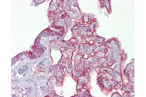 Anti-PTPN11 antibody IHC of human lung.