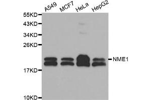 Western blot analysis of extracts of various cell lines, using NME1 antibody (ABIN5970089) at 1/1000 dilution. (NME1 Antikörper  (C-Term))