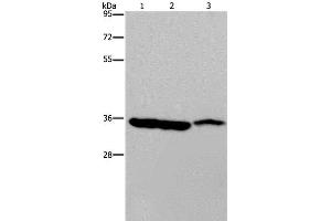 Western Blot analysis of Mouse heart, liver and stomach tissue using MDH1 Polyclonal Antibody at dilution of 1:500 (MDH1 Antikörper)