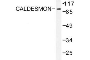 Image no. 1 for anti-Caldesmon 1 (CALD1) antibody (ABIN271923) (Caldesmon Antikörper)