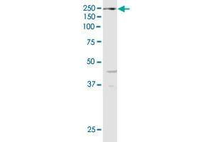 Western Blotting (WB) image for anti-Lysine (K)-Specific Demethylase 6A (KDM6A) (AA 641-740) antibody (ABIN948618)