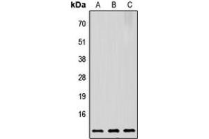 Western blot analysis of Prothymosin alpha expression in HeLa (A), Raw264. (PTMA Antikörper  (C-Term))