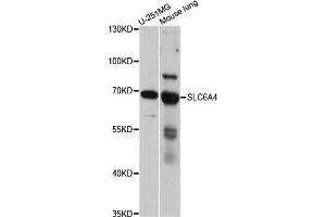 Western blot analysis of extracts of various cell lines, using SLC6A4 antibody. (SLC6A4 Antikörper)