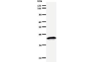 Western Blotting (WB) image for anti-Mediator Complex Subunit 26 (MED26) antibody (ABIN931047) (MED26 Antikörper)
