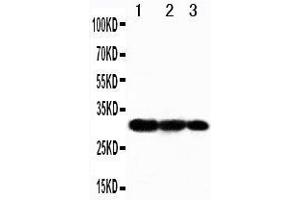 Western Blotting (WB) image for anti-TNF Receptor-Associated Factor 3 (TRAF3) (AA 387-403), (Middle Region) antibody (ABIN3042952)