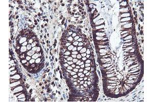 Image no. 14 for anti-Proteasome (Prosome, Macropain) Subunit, beta Type, 7 (PSMB7) (AA 58-277) antibody (ABIN1491598)