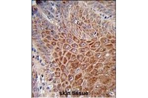 Immunohistochemistry (Paraffin-embedded Sections) (IHC (p)) image for anti-Immunoglobulin Heavy Chain (IgH) (AA 290-320), (C-Term) antibody (ABIN652729)