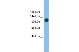 WB Suggested Anti-USP36 Antibody Titration: 0. (USP36 Antikörper  (N-Term))