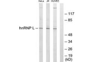 Western blot analysis of extracts from HeLa/Jurkat/HuvEc cells, using hnRNP L Antibody.