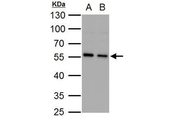 SQSTM1 Antikörper