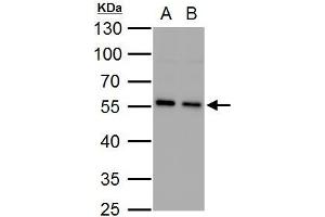 WB Image SQSTM1 antibody [N3C1], Internal detects SQSTM1 protein by western blot analysis. (SQSTM1 Antikörper)