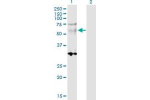 Western Blot analysis of SGCE expression in transfected 293T cell line by SGCE MaxPab polyclonal antibody. (SGCE Antikörper  (AA 1-437))