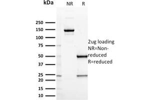 SDS-PAGE Analysis Purified CD127 Mouse Monoclonal Antibody (IL7R/2751). (IL7R Antikörper  (AA 21-236))