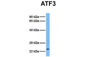 Host:  Rabbit  Target Name:  ATF3  Sample Tissue:  Human 293T  Antibody Dilution:  1. (ATF3 Antikörper  (Middle Region))