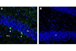 Expression of PTGFRN in rat hippocampal dentate gyrus:Immunohistochemical staining of perfusion-fixed frozen rat brain sections with Anti-PTGFRN (extracellular) Antibody (ABIN7581950), (1:300), followed by goat anti-rabbit-AlexaFluor-488.