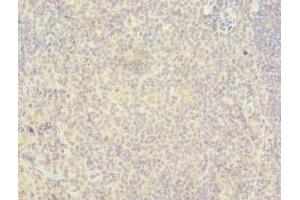 Immunohistochemistry of paraffin-embedded human tonsil tissue using ABIN7167369 at dilution of 1:100 (RAB6B Antikörper  (AA 2-208))