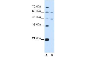 CRELD1 antibody used at 5 ug/ml to detect target protein. (CRELD1 Antikörper  (C-Term))