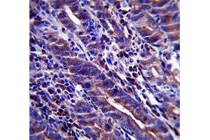 Immunohistochemistry (IHC) image for anti-Mucin 1 (MUC1) (AA 1176-1205) antibody (ABIN3031859)