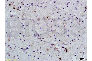 Formalin-fixed and paraffin-embedded rat brain labeled with Anti-BNP Polyclonal Antibody, Unconjugated (ABIN678623) 1:200, overnight at 4 °C, The secondary antibody was Goat Anti-Rabbit IgG, Cy3 conjugated used at 1:200 dilution for 40 minutes at 37 °C. (BNP Antikörper  (AA 85-115))