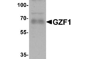 Western blot analysis of GZF1 in human heart tissue lysate with GZF1 antibody at 1 µg/mL.