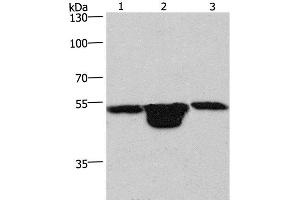 Western Blot analysis of Hela cell, Mouse muscle and kidney tissue using PLEKHO1 Polyclonal Antibody at dilution of 1:200 (PLEKHO1 Antikörper)