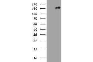 Image no. 1 for anti-Tuberous Sclerosis 1 (TSC1) (AA 836-1164) antibody (ABIN1491686) (TSC1 Antikörper  (AA 836-1164))