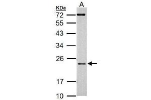 AICDA Antikörper  (N-Term)