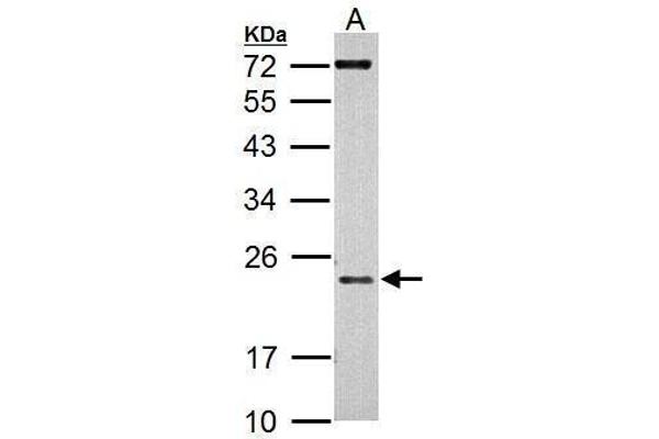 AICDA Antikörper  (N-Term)