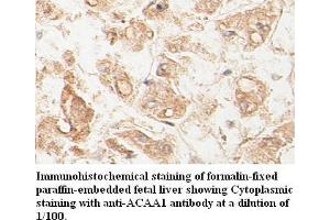 Image no. 1 for anti-Acetyl-CoA Acyltransferase 1 (ACAA1) antibody (ABIN791175) (ACAA1 Antikörper)
