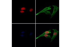 ABIN7094124 and ABIN7098168 staining Hela cells by IF/ICC. (CDC26 Antikörper  (Internal Region))
