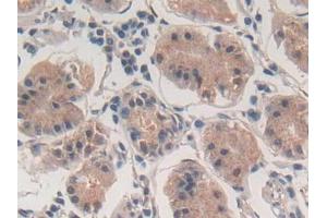 DAB staining on IHC-P; Samples: Human Stomach Tissue (Phospholamban Antikörper  (AA 1-52))