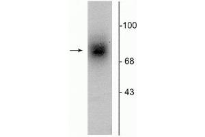 Western blot of human striatal lysate showing specific immunolabeling of the ~88 kDa DAT protein.