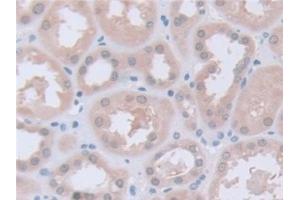 Immunohistochemistry (IHC) image for anti-Phosphoglucomutase 1 (PGM1) (AA 1-235) antibody (ABIN7444190)