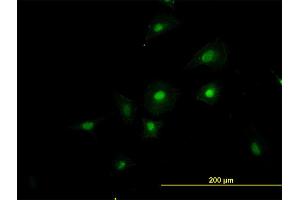 Immunofluorescence (IF) image for anti-RNA Binding Motif Protein 39 (RBM39) (AA 423-472) antibody (ABIN564136)