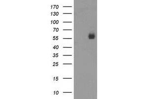 Western Blotting (WB) image for anti-Poliovirus Receptor-Related 1 (Herpesvirus Entry Mediator C) (PVRL1) antibody (ABIN1499678) (PVRL1 Antikörper)