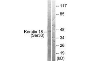 Western blot analysis of extracts from HT29 cells, using Keratin 18 (Phospho-Ser33) Antibody. (Cytokeratin 18 Antikörper  (pSer34))