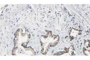 ABIN6275433 at 1/100 staining Human prostate tissue by IHC-P. (CHML Antikörper  (Internal Region))