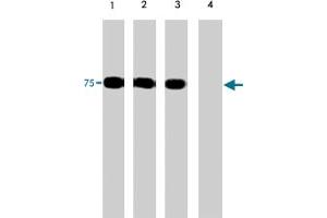 Western blots of human PAK6 recombinant protein phosphorylated by ERK2. (PAK6 Antikörper  (N-Term))