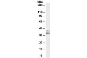 Western blot testing of HeLa (nuclear) cell lysate with NANOG antibody at 0. (Nanog Antikörper)