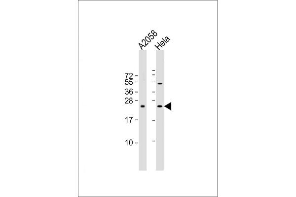 SDHD Antikörper  (N-Term)
