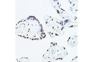 Immunohistochemistry (IHC) image for anti-TEA Domain Family Member 1 (SV40 Transcriptional Enhancer Factor) (TEAD1) (AA 135-215) antibody (ABIN6148982)