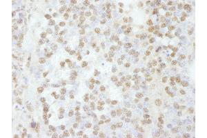 Immunohistochemistry (IHC) image for anti-RNA Binding Motif Protein 16 (RBM16) (C-Term) antibody (ABIN7448761) (RBM16 Antikörper  (C-Term))